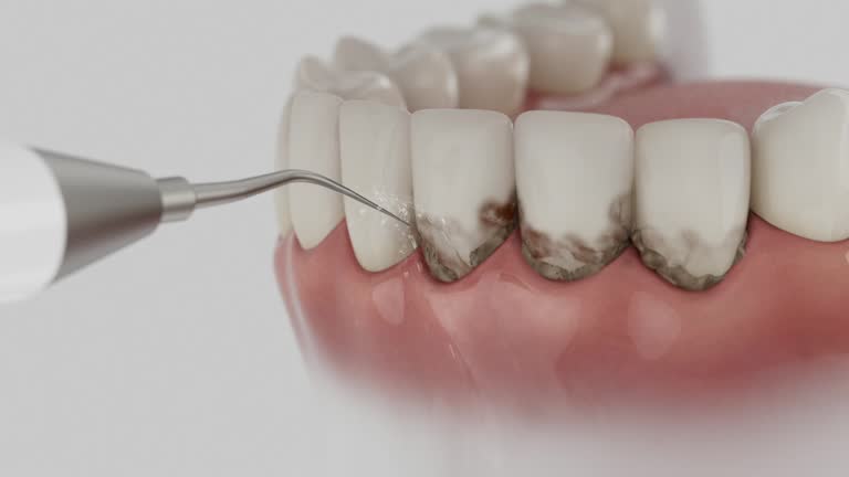 Trusted Root Canal Treatment service in Overlea, MD - Dentist Open Now
